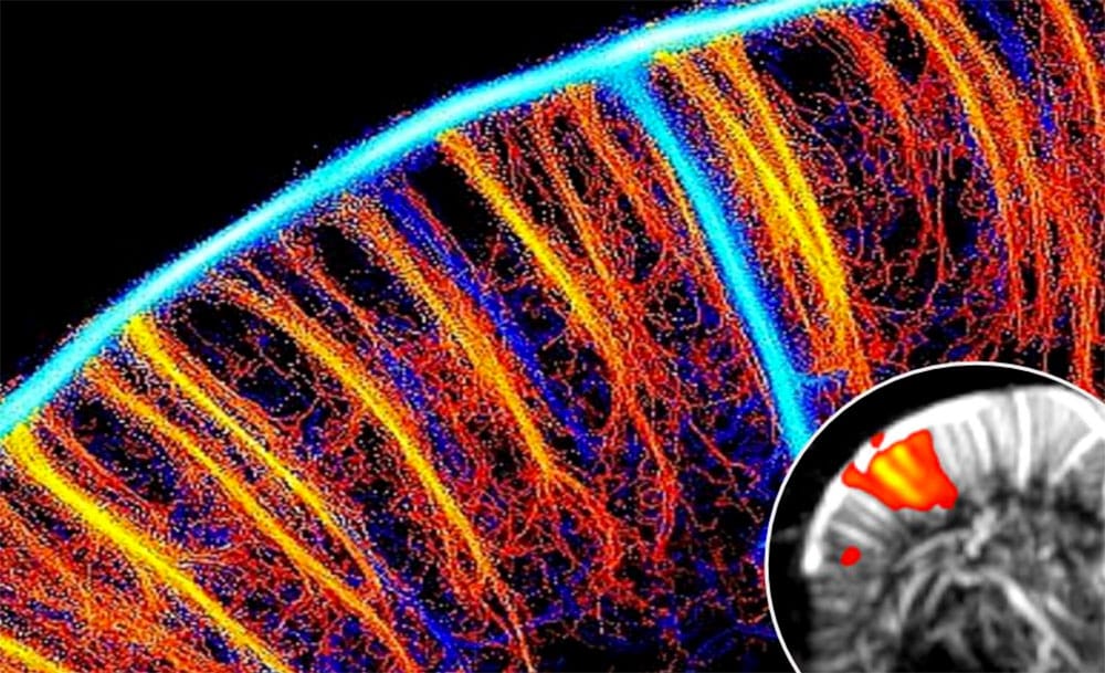 Webinar-Functional Ultrasound Neuroimaging : Principles, Applications & Perspectives. Iconeus